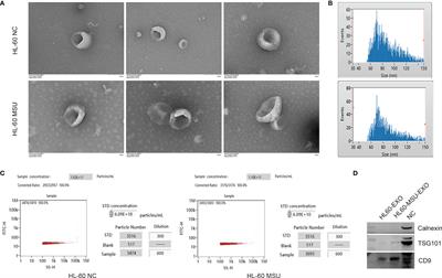 The Inhibition of Osteoblast Viability by Monosodium Urate Crystal-Stimulated Neutrophil-Derived Exosomes